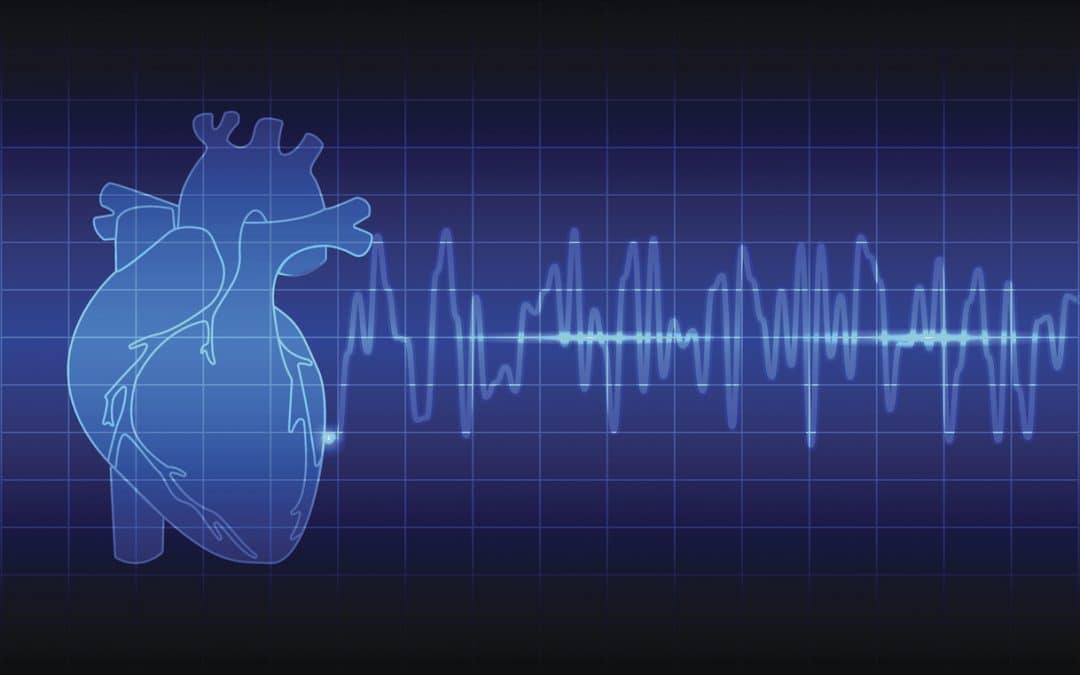 Variabilité de Fréquence Cardiaque: comment l'utiliser pour s'entraîner ?